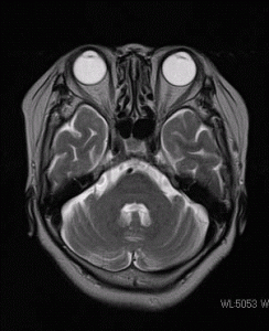 頭部の断面画像